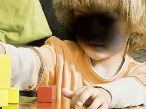 Ein kleines Kind mit einem großen, schwarzen Fleck vor dem Gesicht, spielt mit Holzbausteinen. Der Fleck symbolisiert die Sicht eines Menschen, der an AMD, Alterbedingter Makula-Degeneration leidet.