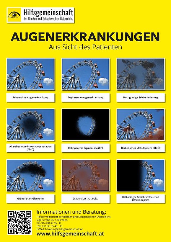 Plakat mit dem Titel "Augenerkrankungen". Einzelne Fotos wie man mit einer bestimmten Augenerkrakung sieht.