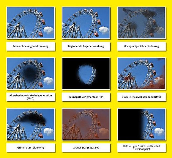 Plakat mit dem Titel "Augenerkrankungen". Einzelne Fotos wie man mit einer bestimmten Augenerkrakung sieht.